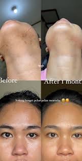 KR132-Madagascar Centella Ampolla iluminadora 100ml