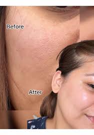 KR158-Centella Poremizing Fresh Ampoule 100ml